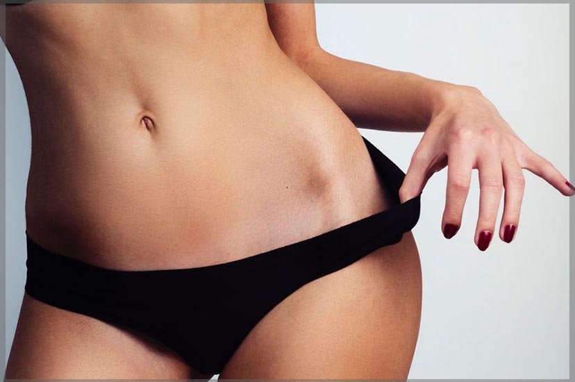 liposuction