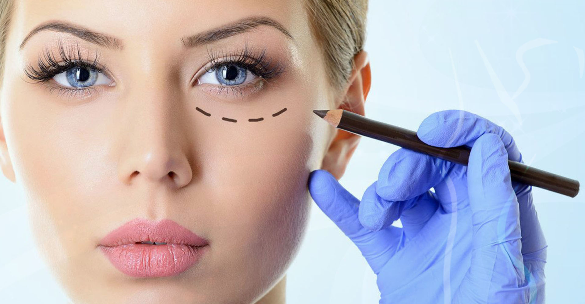 Blepharoplasty